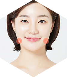 볼살/사각턱