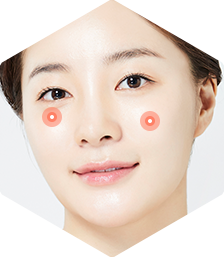 앞광대/다크서클